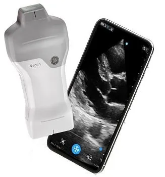 УЗИ аппарат GE HealthCare Vscan Air карманный